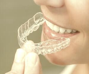هزینه ارتودنسی نامرئی در سال 1401 - بررسی قیمت و جزئیات
