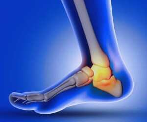 بررسی علائم مشکلات استخوانی