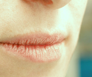 سریعترین راههای درمان ترک لب + بهترین پماد برای ترک لب در کودکان و بزرگسالان