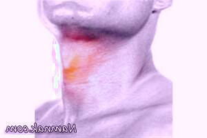 تغییر و اختلال در صدا - خطرات بالقوه