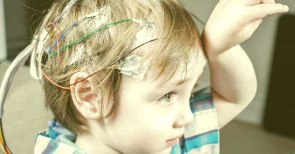 تشخیص صرع کودکان