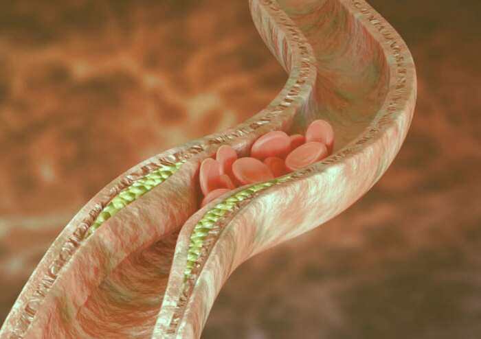 لخته شدن خون