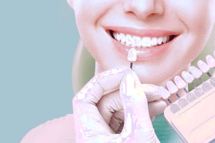 چگونه لامینیت از دندان جدا میشود لامینیت