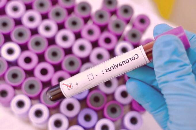 تشخیص ویروس کرونا