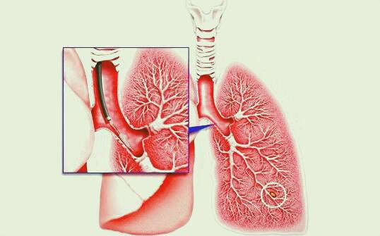 برونکوسکوپی