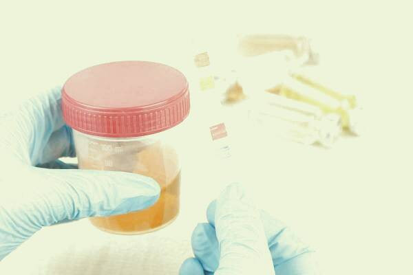 علت ادرار قرمز