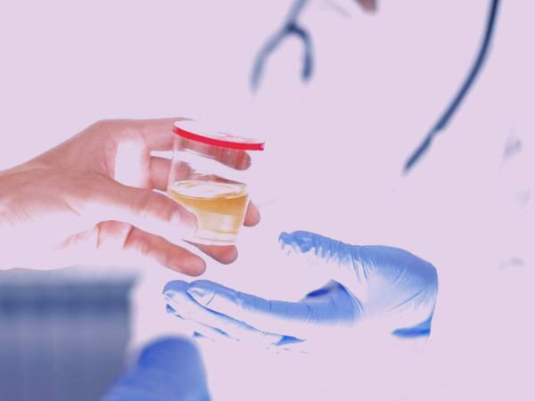 رنگ زرد ادرار