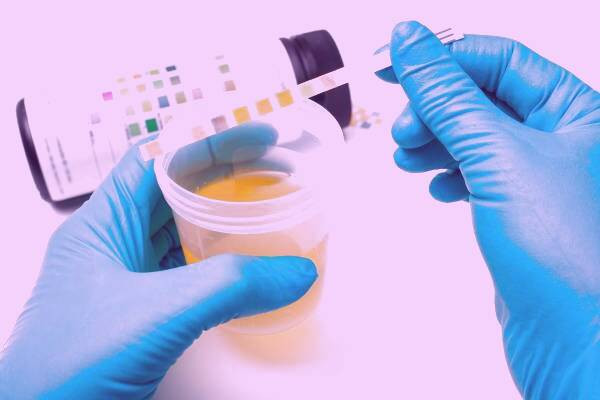 قاروره شناسی