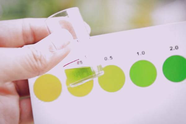 رنگ سبز ادرار