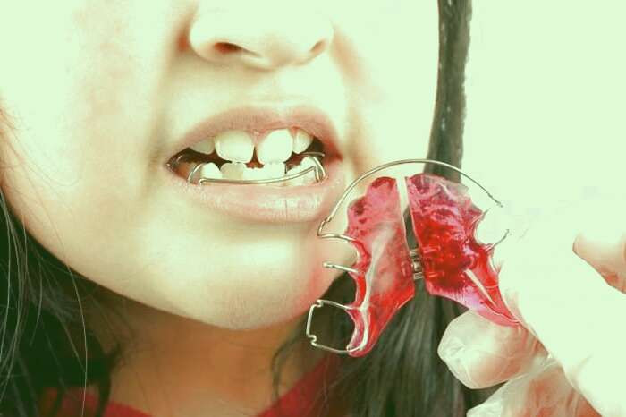 ارتودنسی متحرک