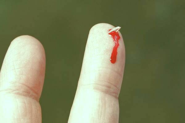 خار در پوست