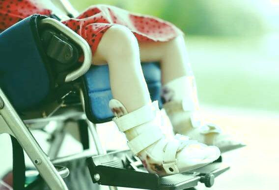 مراقبت از کودک فلج مغزی فلج مغزی کودک