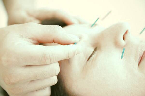 طب سوزنی برای صورت