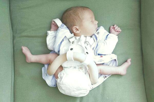 دیسپلازی هیپ