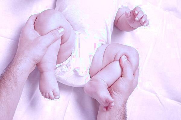 دیسپلازی ران