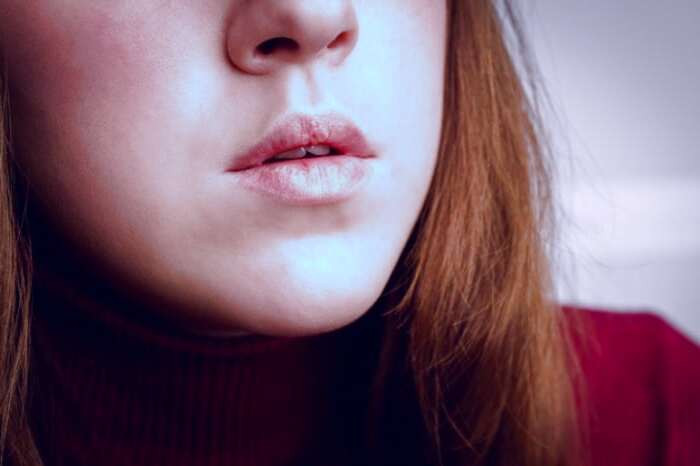 مراقبت از لب