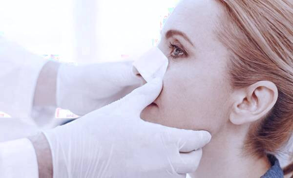 بینی: دیدگاه متخصص دکتر آرش نجف بیگی