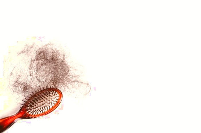 ریزش موی زنان و درمان ریزش مو دختران