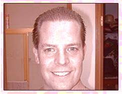 کاشت و مو در کلینیک معتبر با تصاویر