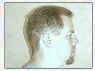 کاشت و مو در کلینیک معتبر با تصاویر