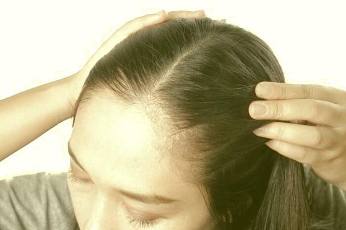 درمان گیاهی ریزش مو مردانه در زنان درمان گیاهی ریزش مو