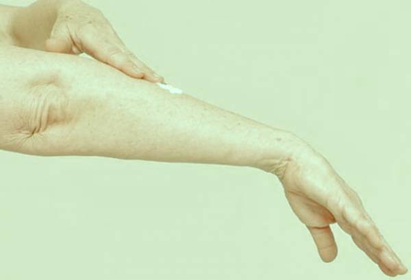 درد راش زونا