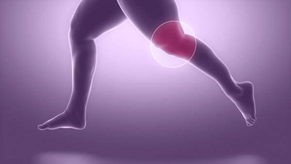 آرتروز زانو