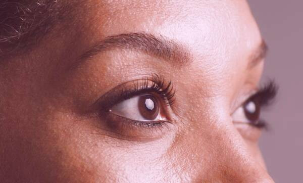 دلایل ایجاد جوش های سفید زیر پوستی 