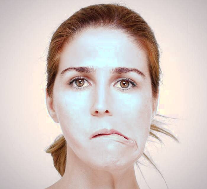 علائم فلج صورت فلج ناگهانی صورت