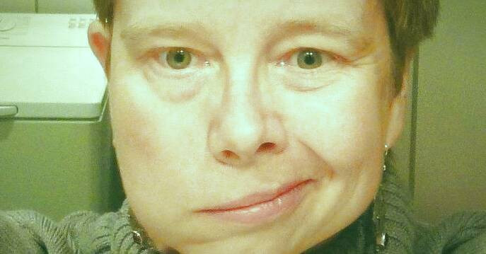 فلج بل از علل تا نشانه ها و درمان فلج بل