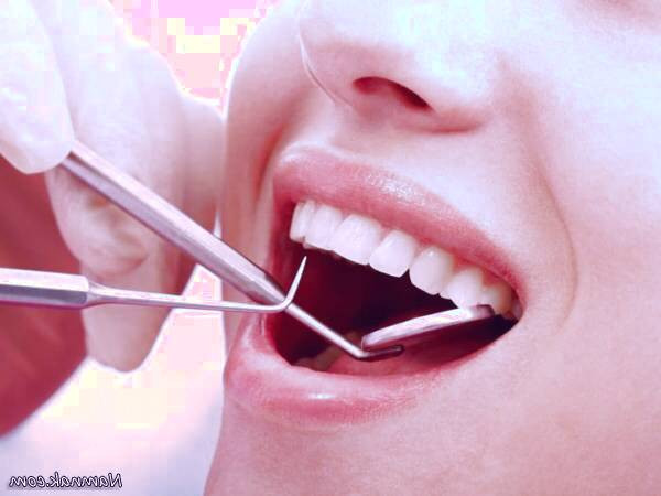 کشیدن دندان