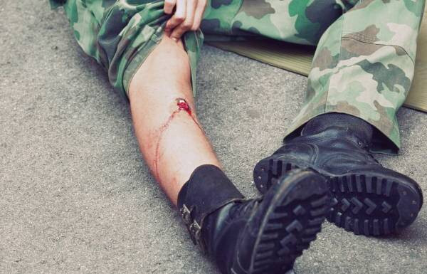 انواع زخم باز