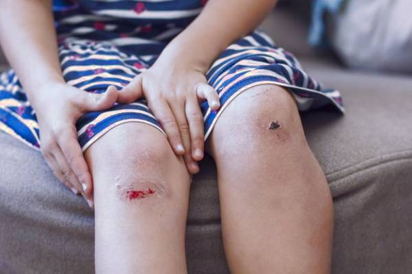 روش مراقبت از زخم باز