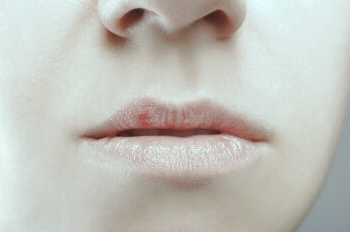 زیادی نمک بدن