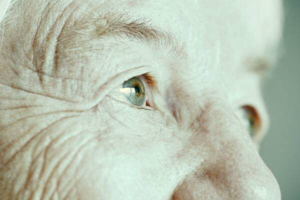 چروک دور چشم