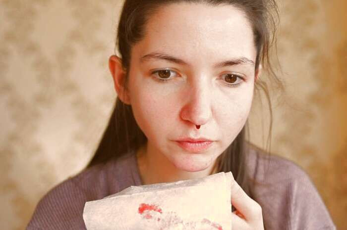 خونریزی بینی