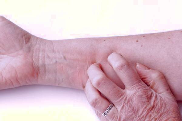 عوارض آمپول نوروبیون