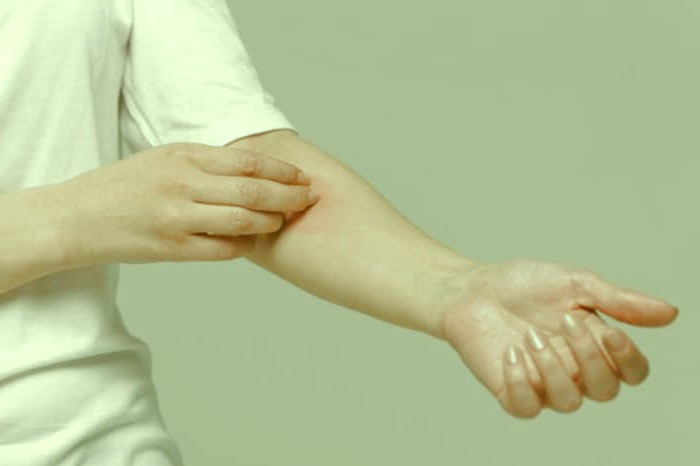 کهیر طولانی