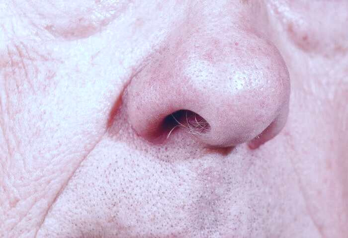 بینی پیر مرد