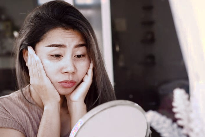 درمان کردن پوست خشک 