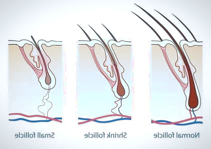 رشد مجدد مو