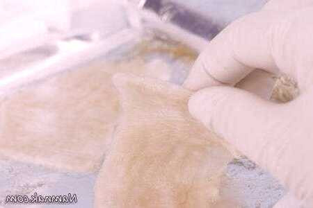 ژل متوقف کننده خونریزی