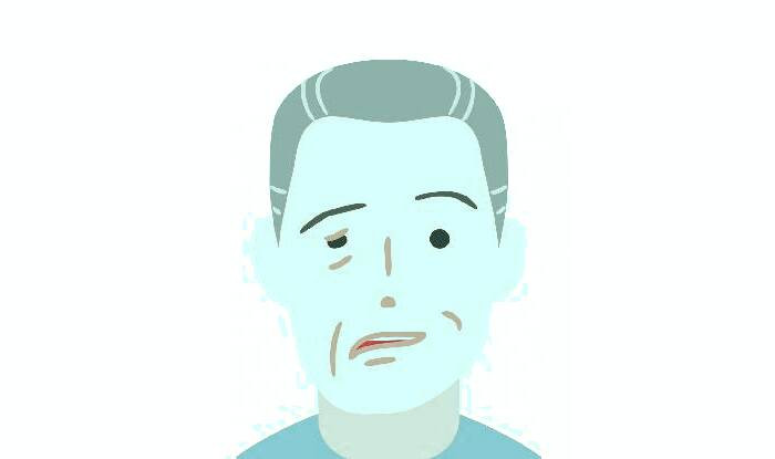 عوارض رامسی هانت