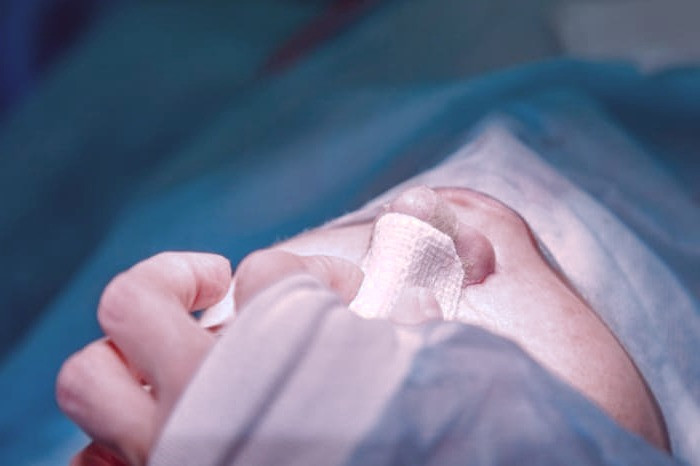 جراحی ترمیمی بینی