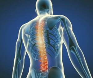 بررسی علائم و راهکارهای درمانی آرتروز ستون فقرات