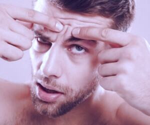 عنوان جدید: درمان نوین آکنه با باکتریوتراپی - جزئیات کشف روش درمانی