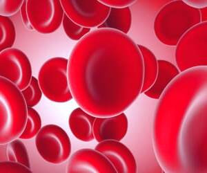 بهبود درمان سرطان خون: کشف جدید و جزئیات