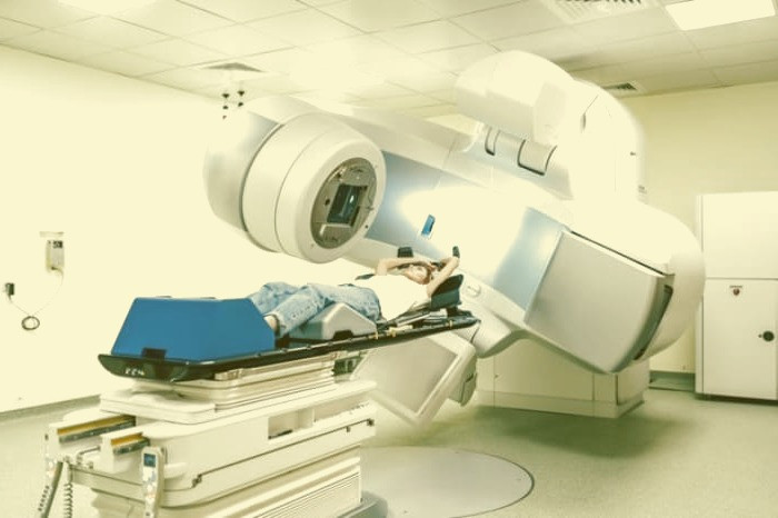 عوارض پرتو درمانی برای زنان