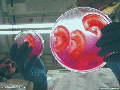 کاشت گوش انسان با سلولهای سیب