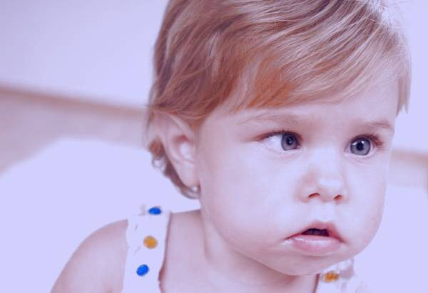 انحراف چشم کودکان